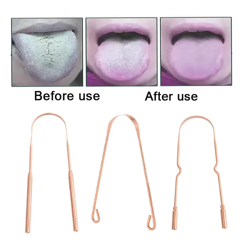 1/3Pcs Pure Copper Tongue Scraper With Metal Box Oral Cleaner Brush Fresh Cleaning Hygiene High Quality Tounge Scraper 3 styles